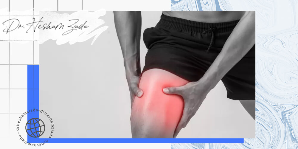 علاج الم الفخذ